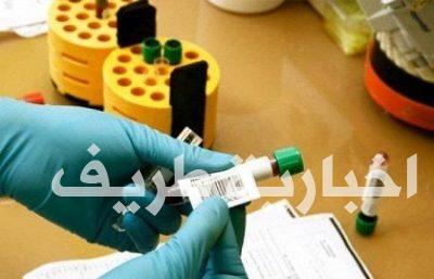 الصحة توضح أن تحليل المخدرات للمقبلين على الزواج يقتصر على الأجانب ولا يشمل المواطنين