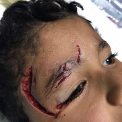 بالصور..شاب يقتل شقيقته طعناً في الشارع بعمان ثم يحضر كرسياً ويجلس بجوارها حتى ماتت