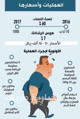 11 ألف عملية تكميم معدة لسعوديين بمستشفى أردني واحد فقط !!