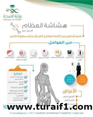 في اليوم العالمي لهشاشة العظام.. “الصحة” توضح كيفية الوقاية من المرض