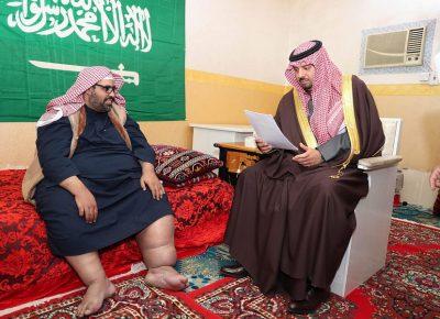 سمو أمير الحدود الشمالية يوجه بتوفير العلاج المناسب لمريض السمنة وداء الفيل خلف الشمري