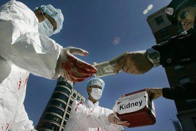 النيابة العامة: السجن و100 ألف ريال لمن يتاجر بالأعضاء البشرية