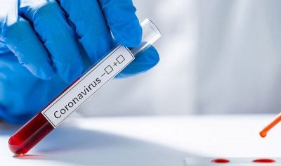 مختص: 4 معلومات عند فحص الأجسام المضادة لـ “كوفيد-19”