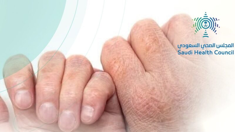 “الصحي السعودي” يُحذّر من علامات الجفاف في الشتاء لدى الكبار والصغار.. تعرّف عليها