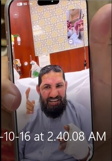 اتصال مرئي.. الدكتور عماد المحمد يطمئن على سلامة ناصر الرويلي أحد مصابي تفجير مطار الملك خالد