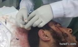 الجوف : عضو بهيئة الأمر بالمعروف يتعرض لإعتداء بساطور على رأسه “صور”