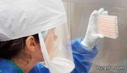 اكتشاف فيروس يصيب الإنسان بالغباء