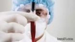 وزارة الصحة المصرية تؤكد ظهور أول حالة إصابة بفيروس “كورونا”