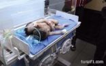 ولادة طفل برأسين في جنوب العراق