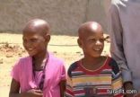 أطفال قرية سودانية يولدون بنوع محير من الصلع