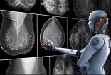 دراسة علمية : الذكاء الاصطناعي يساعد في تشخيص سرطان الثدي