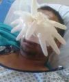 دخول المواطن فواز العنزي في حالة غيبوبة بسبب خطأ طبي أثناء عملية في الأنف بالأردن