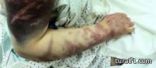 حراسة أمنية مشددة على الجناح الطبي لسعودية تعرضت للتعذيب على مدى 11 ساعة