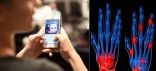 “داء الآيفون”.. الهواتف الذكية تسبب ضمور مفاصل اليد وأطباء يحذرون
