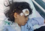 سقوط مقذوف عسكري يؤدي لإصابة إمرأة وطفلتين بمحافظة العارضة